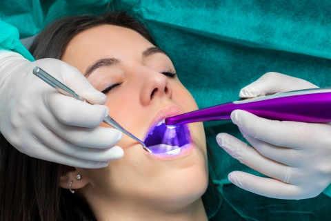 Dental Inlays & Onlays Orléans