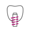 Restorative Dentistry Restorative Dentistry